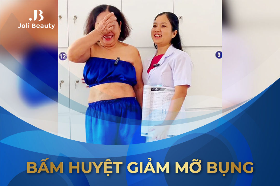 bấm huyệt giảm mỡ bụng