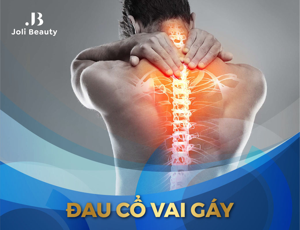 Đau mỏi vai gáy